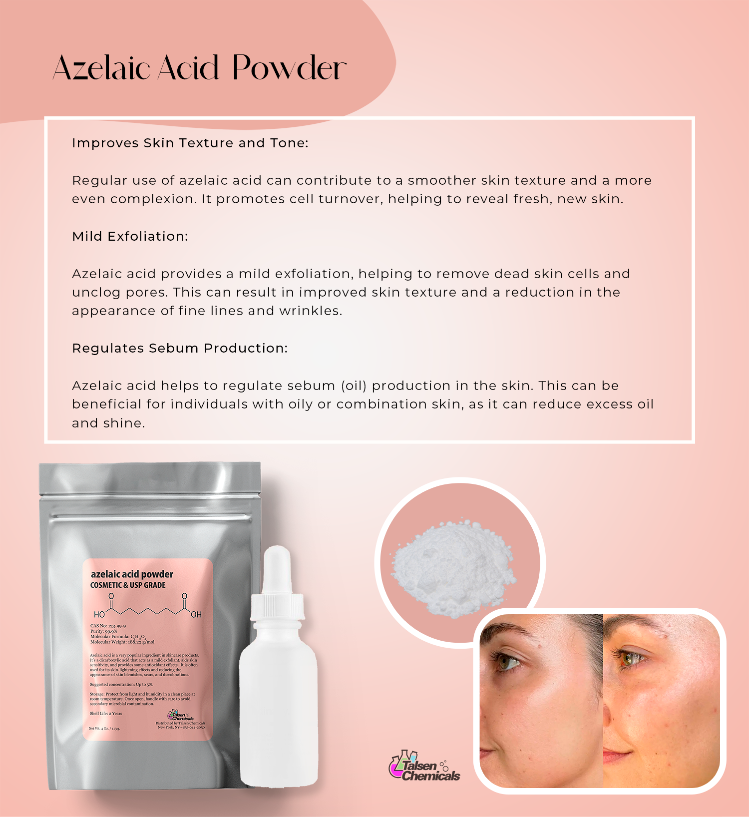 Azhelax Powder Azelaic Acid Powder – TALSEN CHEM