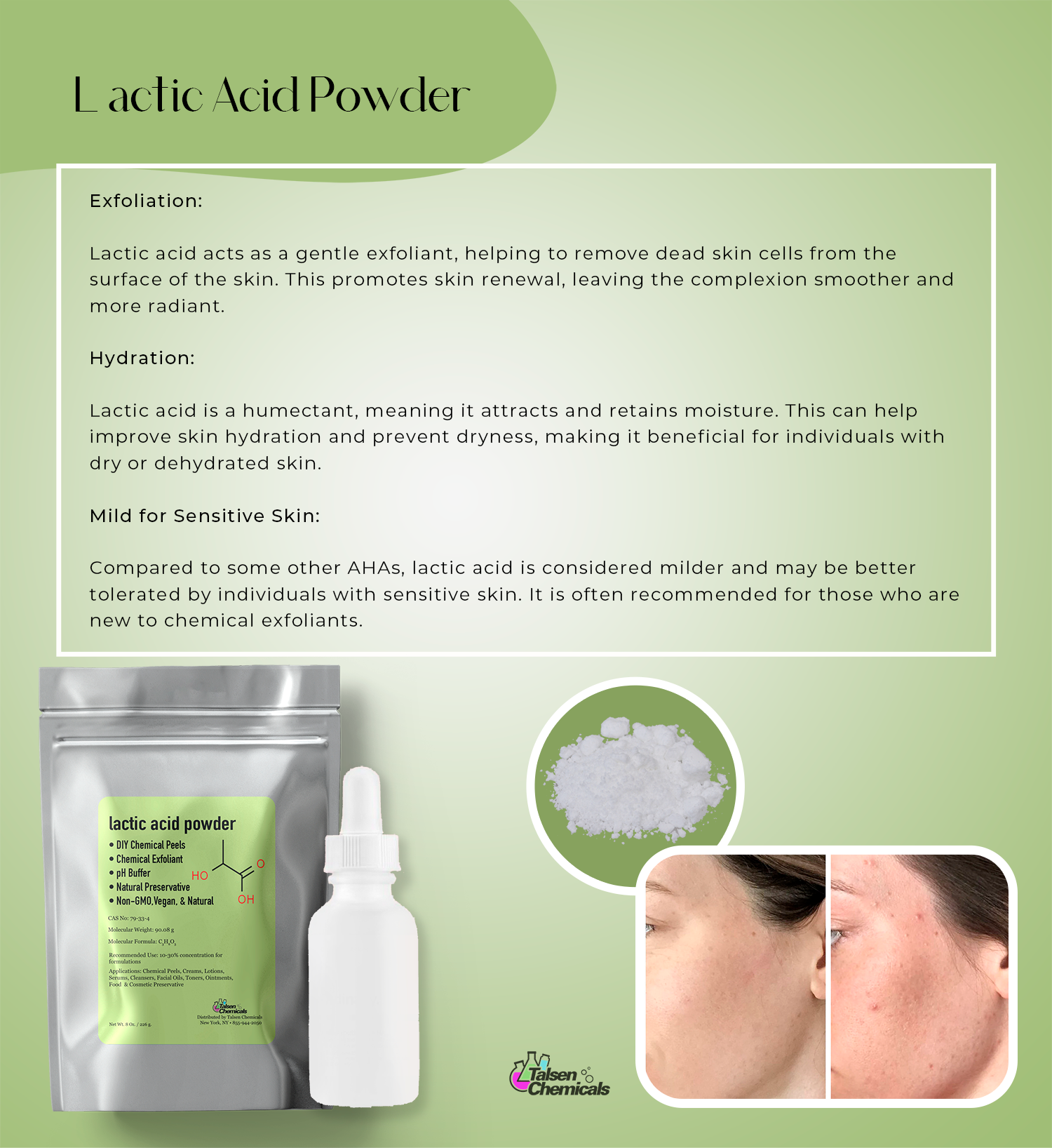 Lactic Acid Powder